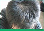 预防脱发的方法有哪些(预防脱发的小妙招送给你)-冷眸生活