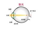 散光可以矫正过来吗(散光可以治好吗)-冷眸生活